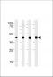 SRD5A3 Antibody (C-term)